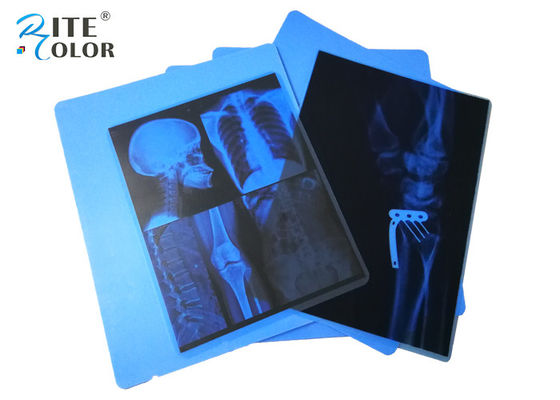 Inkjet PET Medical Imaging Blue X Ray Film Untuk Printer Canon Pixma