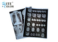 PET Base X Ray Sheet Film Radiology Imaging Film Untuk DR CT 100 Sheets Per Pack