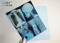Film Pencitraan Medis Inkjet Blue Radiology