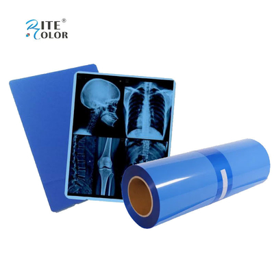IMATEC Blue PET Inkjet Medical CR X-Ray Radiography Film Untuk Printer Canon