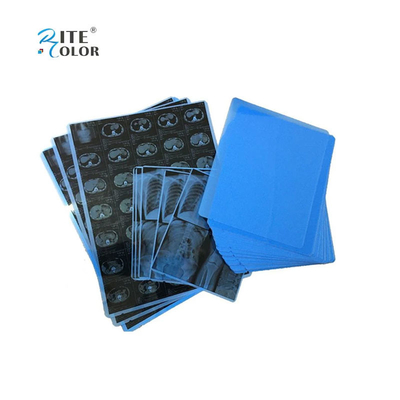 Inkjet Printing PET Blue Medical Film Untuk Sinar X A4 8x10 14x17 Sheets