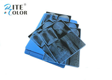 Bahan Medis Biru Sensitif X Ray Film PET Untuk Pencetakan Gambar Inkjet