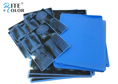 11X14 Inch Laser Pencitraan Film A4 PET Inkjet Medis Dry X Ray Film Untuk CT CR MRT