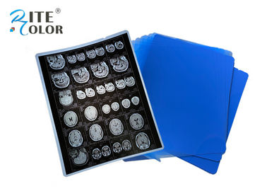 PET Base X Ray Sheet Film Radiology Imaging Film Untuk DR CT 100 Sheets Per Pack