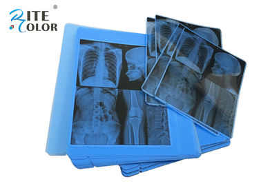 Radiologi Blue X Ray Medical Imaging Film 210um Tebal Untuk Printer Inkjet Epson