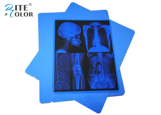 Low Fog A4 Blue PET Dry Pigment Inkjet 210 Mikron Film Sinar X Medis Ramah Lingkungan