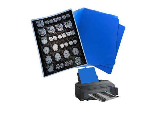 210um 8x10 A3 A4 Blue Medical Inkjet Film untuk Radiologi X-Ray Imaging Output
